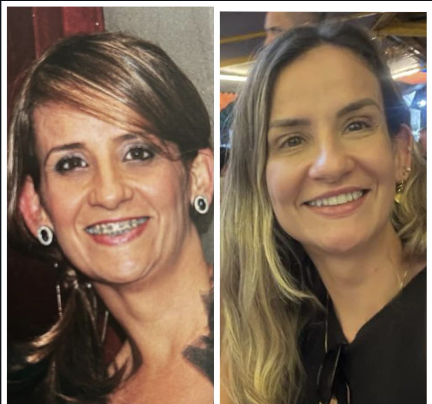 Antes e depois de procedimento facial